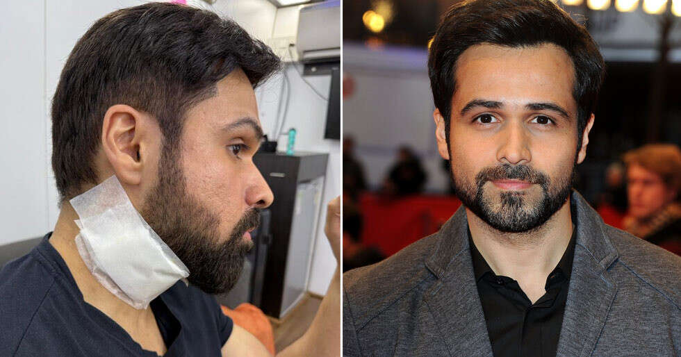 Emraan Hashmi will get injured on units of Goodachari 2